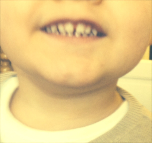 Quenottes_Humeurdemoutard